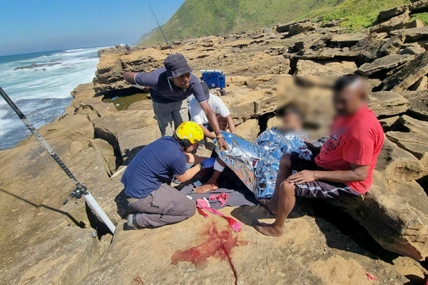 Durban angler breaks leg
